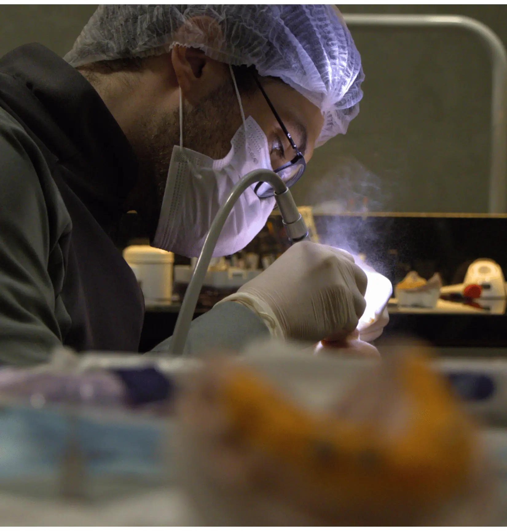 Caso real de clareamento com orientação profissional 1